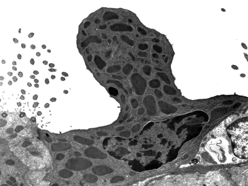 Pulmón de rsatón – célula de Clara en el epitelio pulmonar