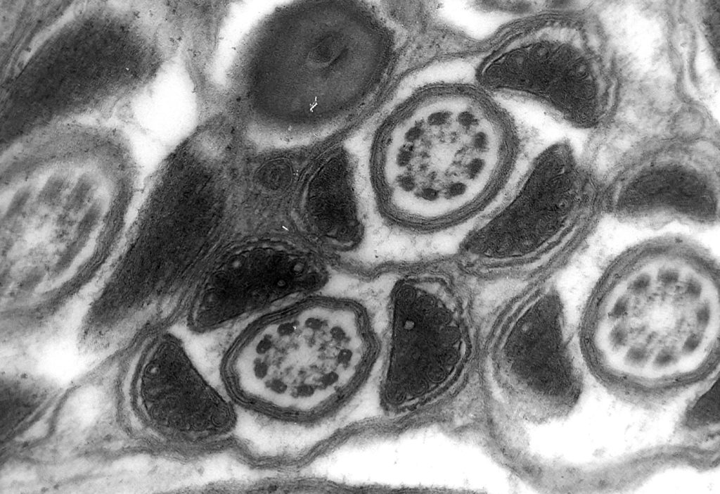 2 corte transversal de flajelo de espermatozoide de escorpion
