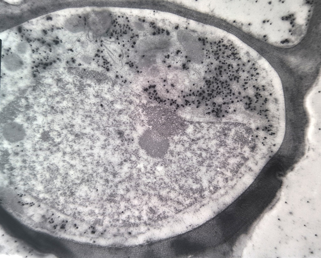 6 Inmunomarcacion viral (Sweet potato feathery mosaic virus)