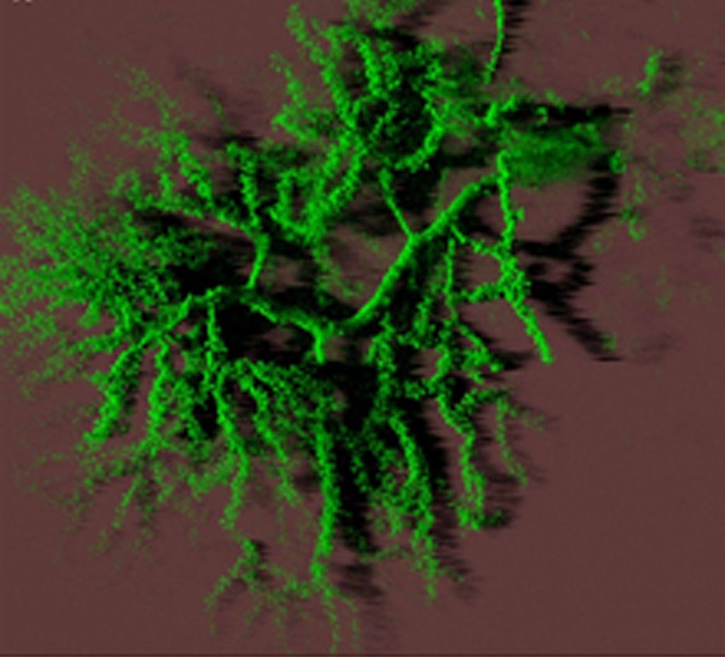 Reconstrucción en 3 D al confocal del árbol dendrítico de una neurona del cerebelo inyectada con faloidina-eosina