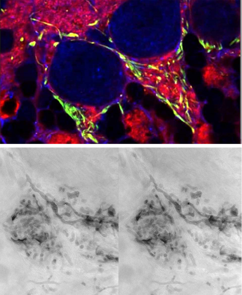 Microscopia correlativa (confocal/ tomografía electrónica) de una neurona del primer segmento axonal de una neurona de Purkinje